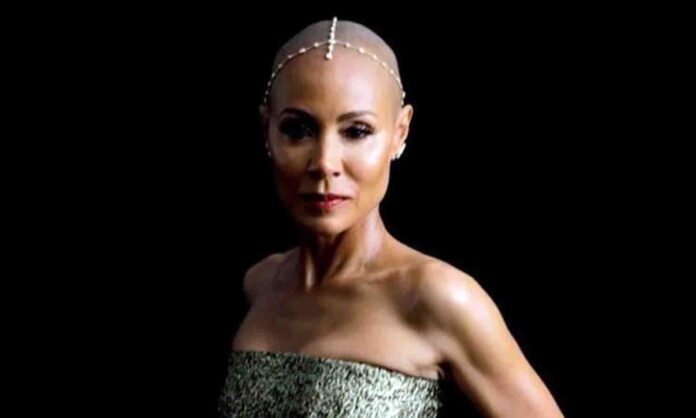 alopecia (3) que es alopecia