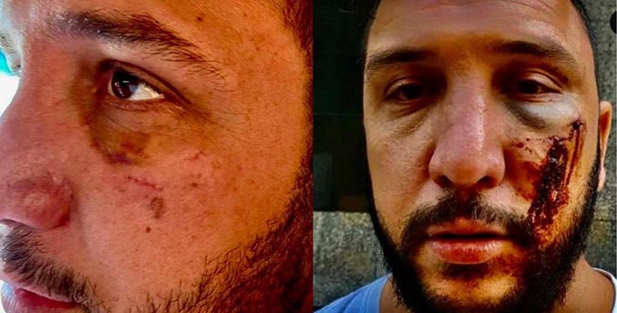 Golpiza en Casino de Valencia Saab Seguridad
