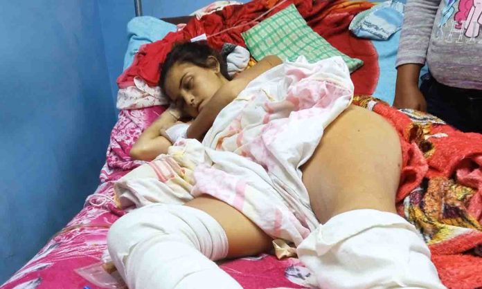 joven abdomen abierto (1) joven herida abierta abdomen