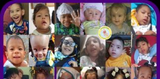 niños microcefalia