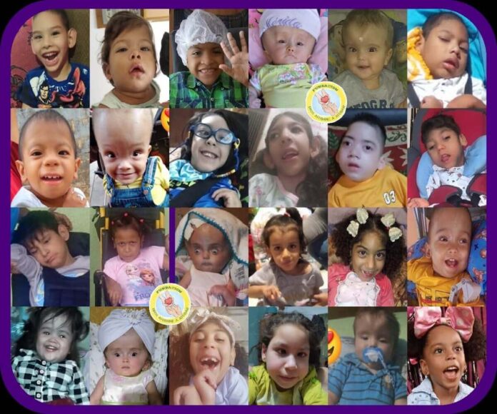 NiñosMicrocefalia (1) niños microcefalia