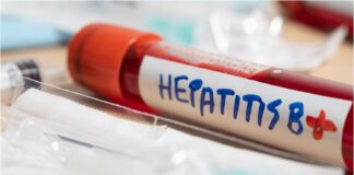 hepatitis