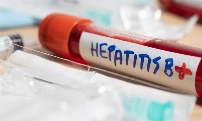 hepatitis (1) hepatitis