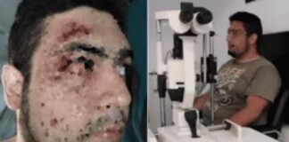 Venezolano Argentina golpeado Mar del Plata confundido por ladrón