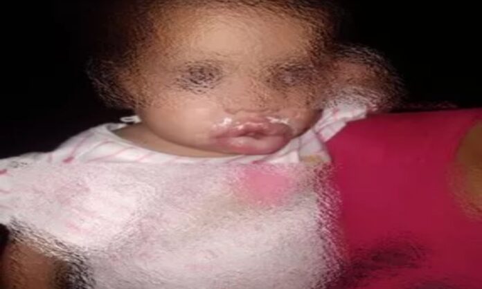 sujeto le quemó la boca a su hija de año Portuguesa